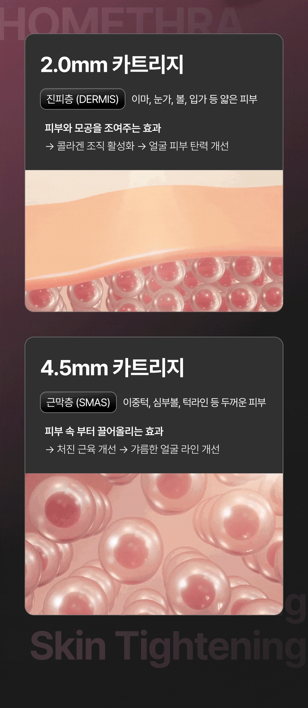 [아띠베뷰티] 홈쎄라 베이직케어 (5만샷 100만도트) (48개월) (2026) 상세 이미지 10